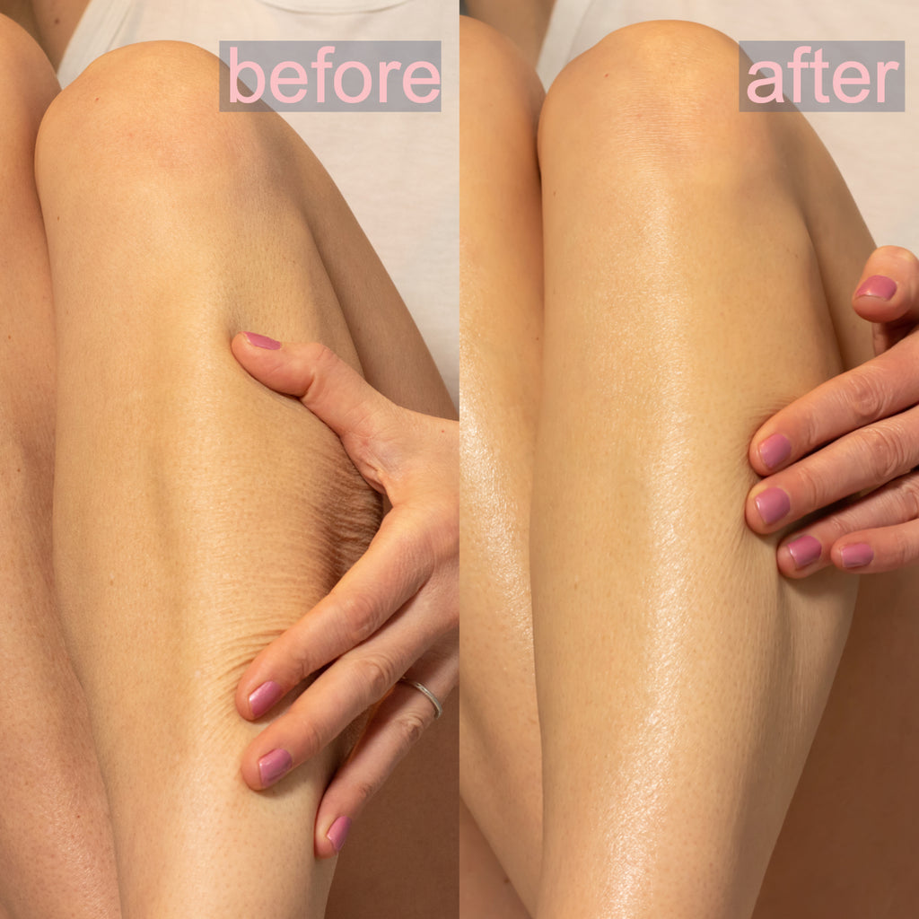 Before and after showing skin appearance before and after using The Butter Bar moisturizer